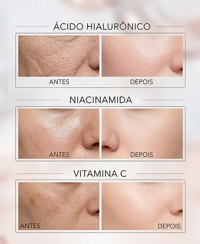 Melhor hidratante para pele oleosa e madura imagem