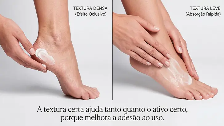 Qual o melhor creme para rachaduras nos pés imagem